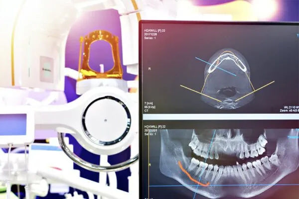 Digital dental X-ray imaging