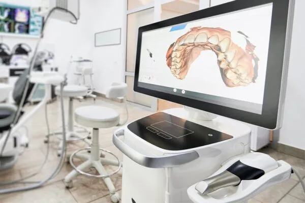 iTero intra-oral digital scanner